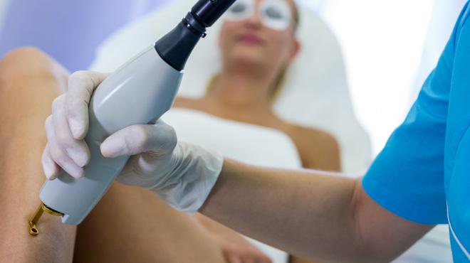 home laser treatments