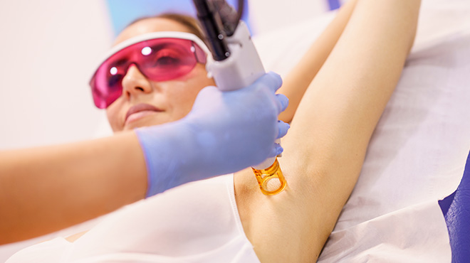 Laser Hair Removal