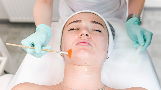 Chemical Peel vs Microneedling